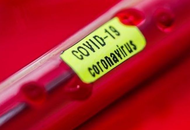 Primeiro caso COVID-19/CORONAVÍRUS é registrado em Nazaré Paulista